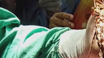 Una mujer come joyas y enferma gravemente.