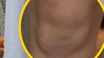 Las rodillas de Beth parecen dos caras de bebé.