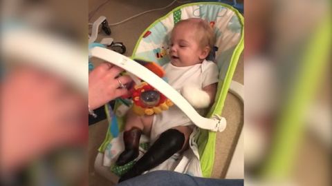 El pequeño Oliver Aisthorpe contrajo sepsis en sus brazos y piernas.