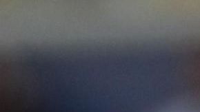 Cristiano Ronaldo se ha sometido, al menos, a 5 cirugías estéticas.