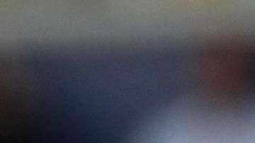 Cristiano Ronaldo se ha sometido, al menos, a 5 cirugías estéticas.