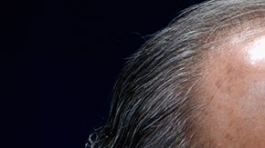 El sobrino del exmandatario estaba a bordo de un auto oficial.