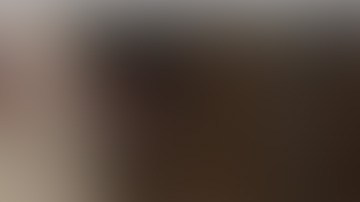 Tras ser evaluado por médicos, se determinó que Nico, requería ser intervenido de manera quirúrgica tras un choque con el portero de Tijuana