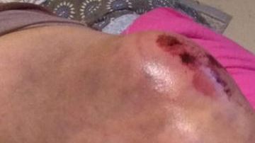 La mujer supuestamente sufrió heridas en la cabeza, una rodilla y un brazo a raíz del incidente.