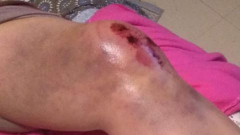 La mujer supuestamente sufrió heridas en la cabeza, una rodilla y un brazo a raíz del incidente.