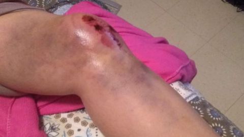 La mujer supuestamente sufrió heridas en la cabeza, una rodilla y un brazo a raíz del incidente.