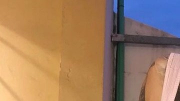 Así luce esta joven de 24 años adicta a la cirugía plástica.