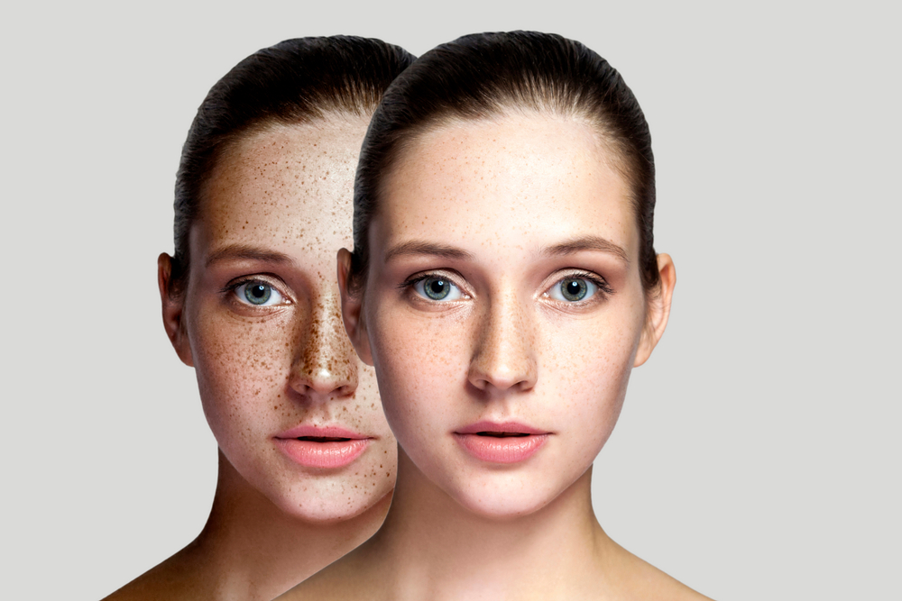 Las 5 mejores cremas por menos de $30 para eliminar las manchas de la piel del rostro