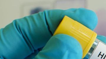 Una prueba positiva de VIH.