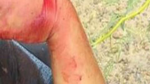 VIDEO Cartel del Noreste le destroza brazo a mujer polica en balacera en la frontera