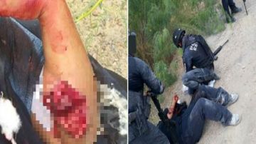 VIDEO Cartel del Noreste le destroza brazo a mujer polica en balacera en la frontera