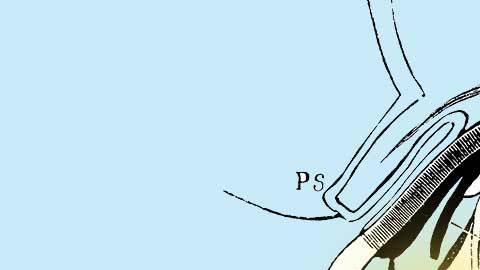 cr-health-hero-cataract-surgery-v2-0318