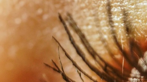 retinopatía diabética