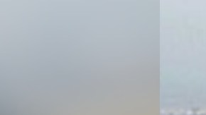 Seguro Aquino se ha de dar de topes mientras ella posa topless.