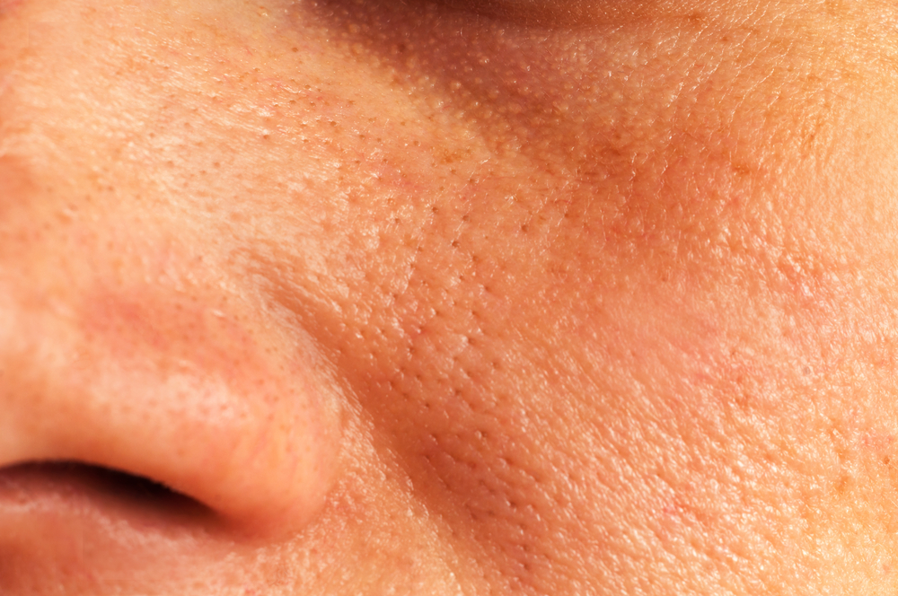 muy abiertos los poros tu cara? 4 tratamientos para limpiarlos y mejorar su - La Opinión