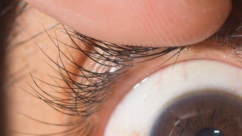 ojo