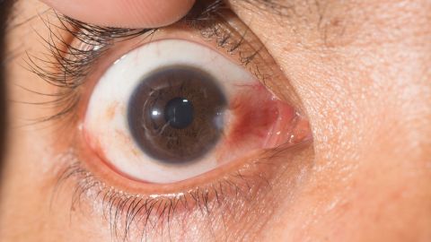 ojo
