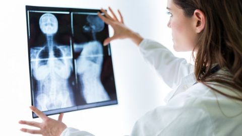 El de pecho es el cáncer más frecuente en las mujeres y afecta globalmente a 2,1 millones de mujeres por año, según la OMS.