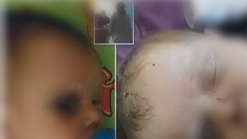 El pequeñito aún se encuentra delicado.