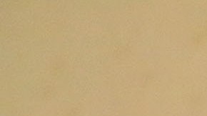 El estado de salud de La Parka está mejorando.