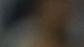 Hurtado sufrió ruptura del tendón de Aquiles en la pierna izquierda.