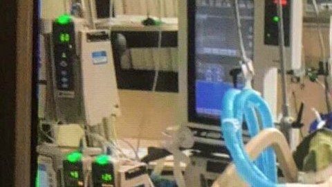 Mayra Todd sufrió un aneurisma en la aorta torácica y trombosis en la pierna izquierda hace tres años. Desde entonces debe tomar cuatro medicamentos. (Suministrada)