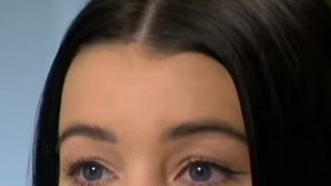 Mikayla Stutchbery casi queda ciega por los implantes labiales.