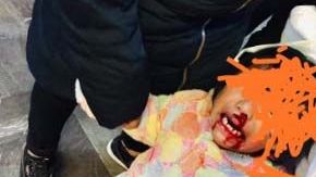 El incidente se reportó en la estación Candelaria, de la Línea 1.