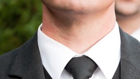 El cuerpo quedó irreconocible y de ahí la confusión.