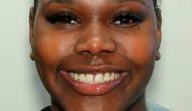 Alexis Crawford.
