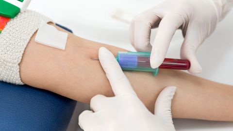Pueden detectarse tipos de cáncer más comunes.