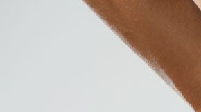 cirugía láser anal