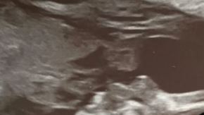 El parecido es asombroso.