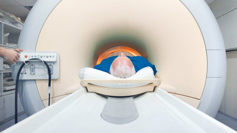 Las pruebas con imágenes de resonancia magnética servirían para reducir el número de hombres que necesita hacer una biopsia.