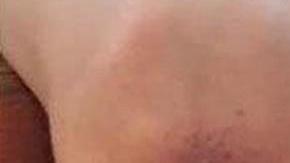 El niño tuvo que ser intervenido por las terribles heridas que le causó el castigo.