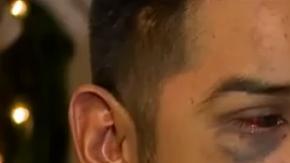 Jacob Servin afirma que fue víctima de un "crimen racista de odio" de parte de oficiales de la cárcel de San Joaquín.