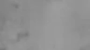 Le encontraron esto en el interior del ano.