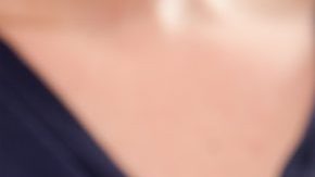 carillas dentales