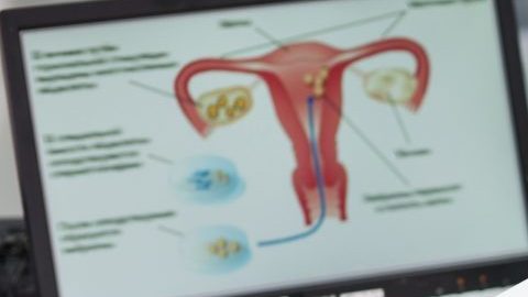 prolapso uterino