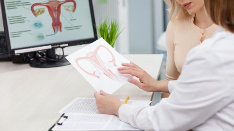 prolapso uterino