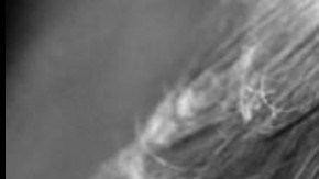 El padre del portero felino llevaba varios días intentando recuperarse de un infarto.