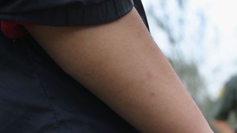 Las niñas enfrentan enfermedades respiratorias.