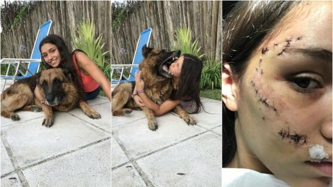 Así quedó después del ataque del perro / Twitter @LaruSanson