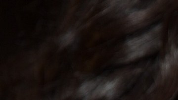 Era jugador de béisbol hasta que sufrió un accidente y dijo que poder pararse con su nueva esposa fue el mejor momento de su vida.