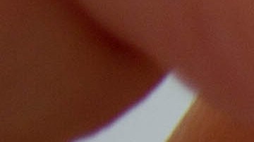 Los doctores creyeron que se trataba de un problema gastrointestinal.