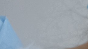 Un paciente de trasplante de órgano en Michigan muere de rabia