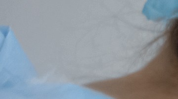 Un paciente de trasplante de órgano en Michigan muere de rabia