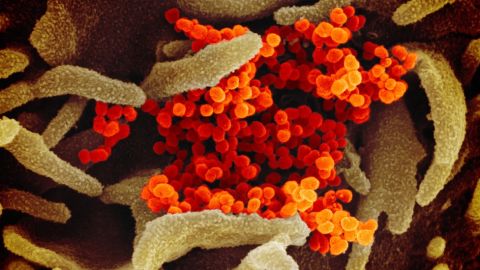 El Covid_19 pertenece a la familia de los Coronavirus.