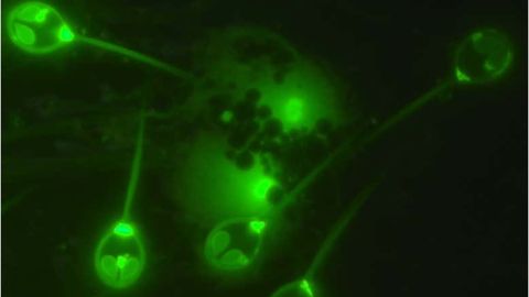 111051083_parasite-no-oxygen