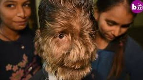 Imágenes de la extraña afección que padece un adolescent indio.